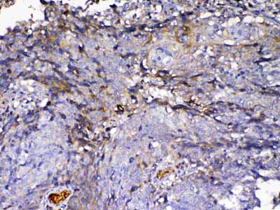 2 - Anti-IGFBP2 Picoband Antibody ABO12941
