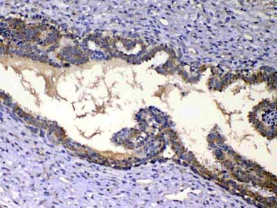 2 - Anti-IGFBP2 Picoband Antibody ABO12941