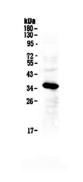 1 - Anti-IGFBP2 Picoband Antibody ABO12941