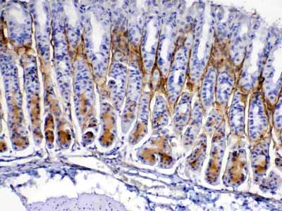 2 - Anti-Periostin Picoband Antibody ABO12942