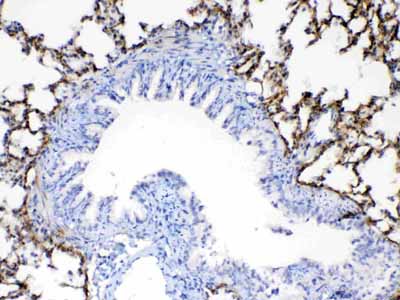 2 - Anti-Periostin Picoband Antibody ABO12942