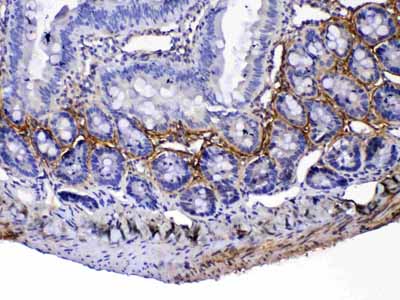 2 - Anti-Periostin Picoband Antibody ABO12942