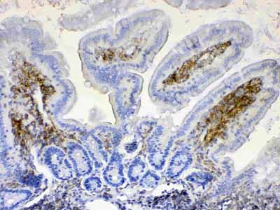 2 - Anti-Lyn Picoband Antibody ABO12946