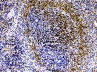 2 - Anti-Lyn Picoband Antibody ABO12946