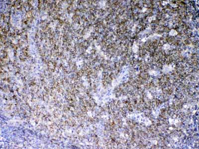 2 - Anti-Lyn Picoband Antibody ABO12946