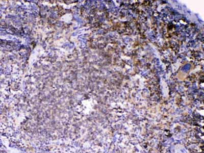 2 - Anti-Lyn Picoband Antibody ABO12946