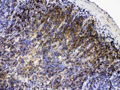 2 - Anti-Lyn Picoband Antibody ABO12946