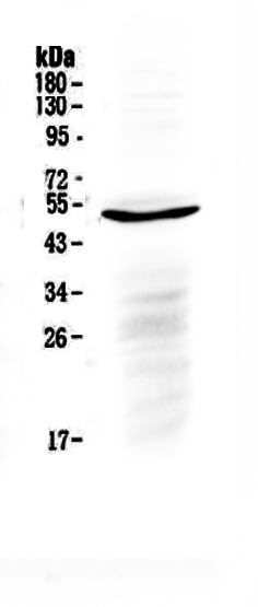 1 - Anti-IL6R Picoband Antibody ABO12947