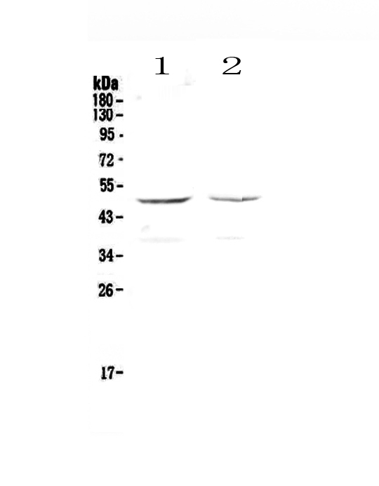 1 - Anti-GALT Picoband Antibody ABO12948