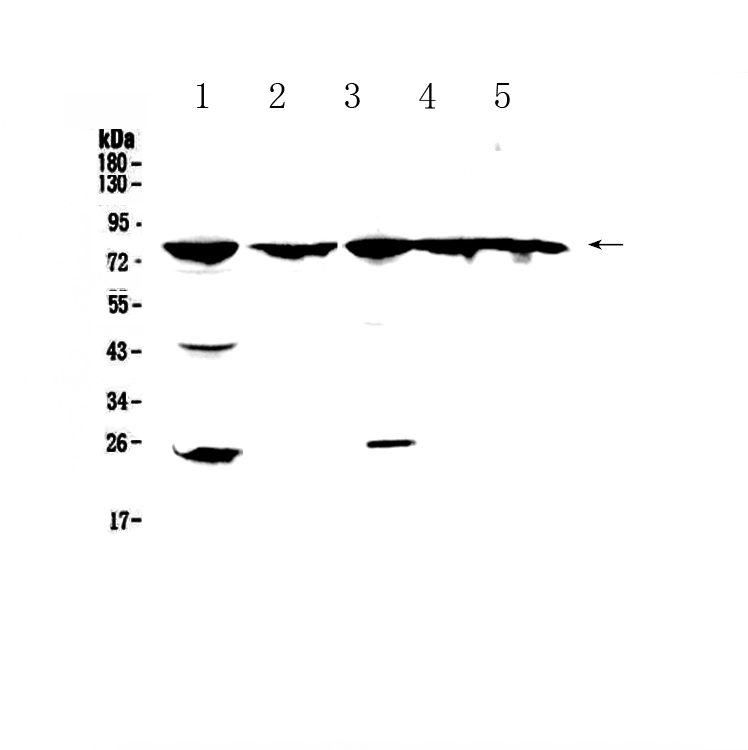 1 - Anti-GRK2 Picoband Antibody ABO12950