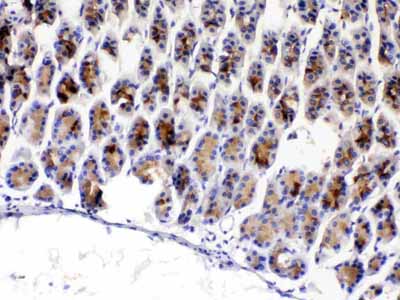2 - Anti-TFF3 Picoband Antibody ABO12957