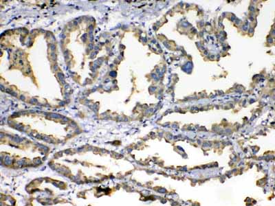 2 - Anti-SOD3 Picoband Antibody ABO12963