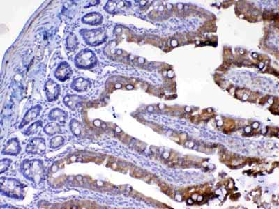 2 - Anti-UGT1A1 Picoband Antibody ABO12964