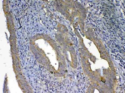 2 - Anti-UGT1A1 Picoband Antibody ABO12964