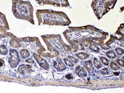 2 - Anti-UGT1A1 Picoband Antibody ABO12964