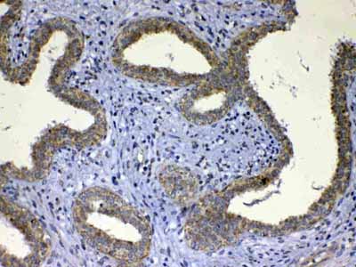 2 - Anti-UGT1A1 Picoband Antibody ABO12964