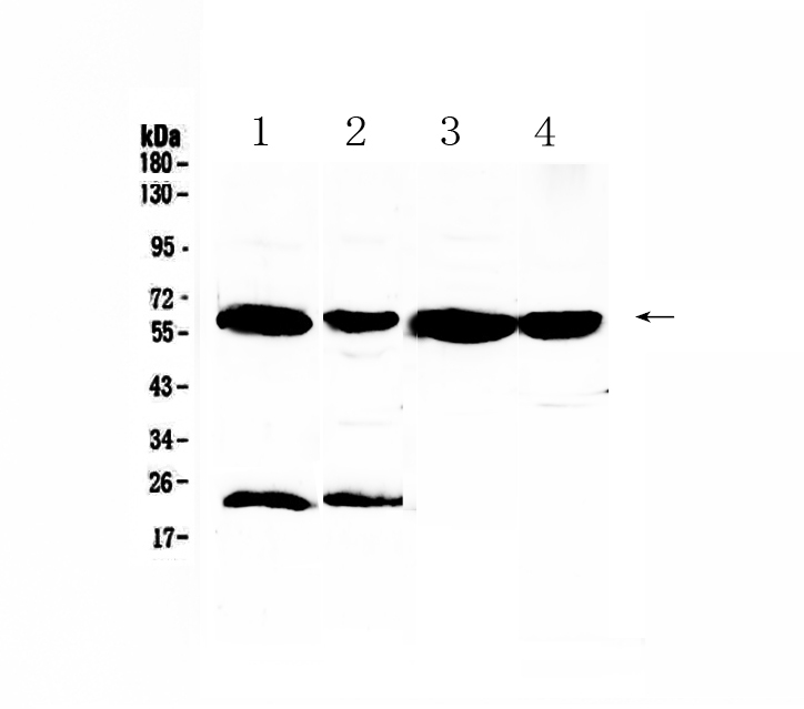 1 - Anti-UGT1A1 Picoband Antibody ABO12964