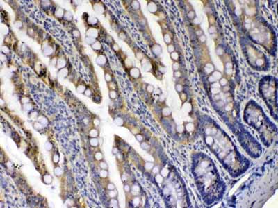 2 - Anti-Xanthine Oxidase Picoband Antibody ABO12966