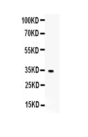 1 - Anti-IGFBP5 Picoband Antibody ABO12970