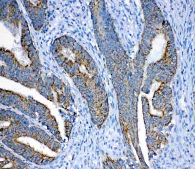 2 - Anti-FH Picoband Antibody ABO12975