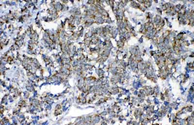 2 - Anti-FH Picoband Antibody ABO12975