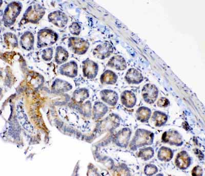 2 - Anti-FH Picoband Antibody ABO12975