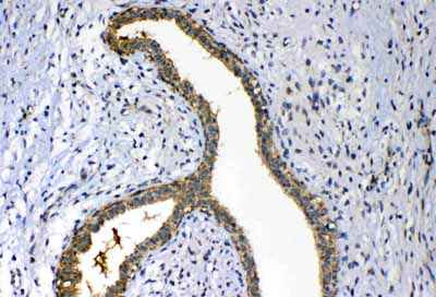 2 - Anti-FH Picoband Antibody ABO12975