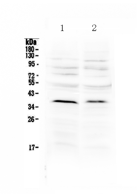 1 - Anti-MATH1/HATH1 Picoband Antibody ABO12980