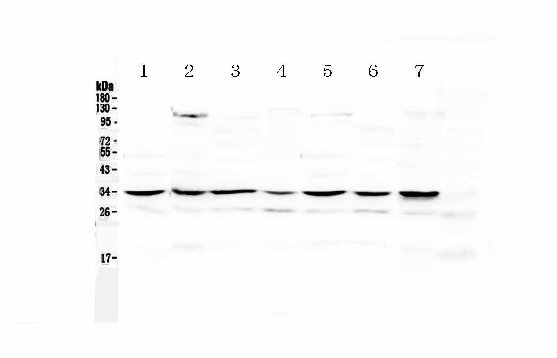 1 - Anti-UCP2 Picoband Antibody ABO12981