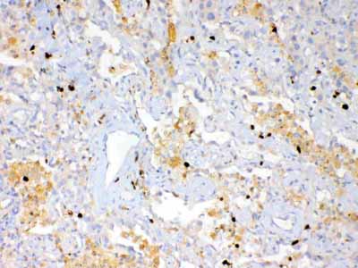 2 - Anti-Psoriasin Picoband Antibody ABO12982