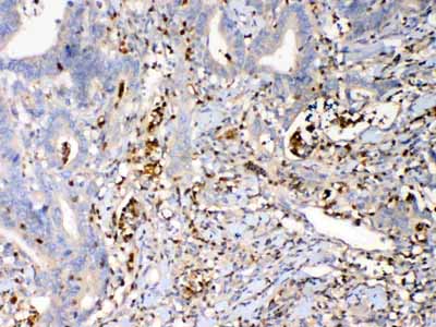 2 - Anti-Psoriasin Picoband Antibody ABO12982