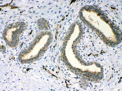 2 - Anti-PPID Picoband Antibody ABO12984