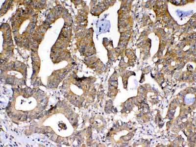 2 - Anti-PPID Picoband Antibody ABO12984