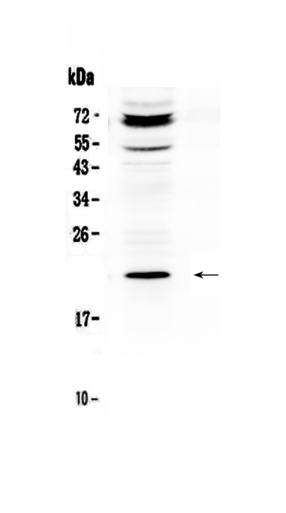 1 - Anti-C19orf80 Picoband Antibody ABO12985