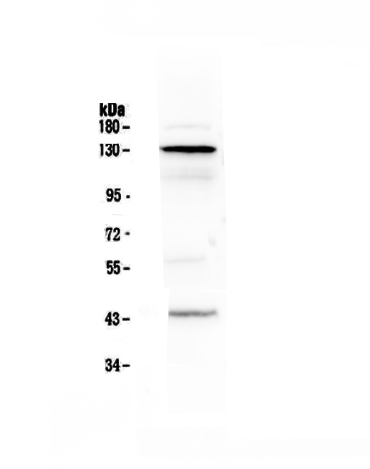 1 - Anti-VE Cadherin Picoband Antibody ABO12991