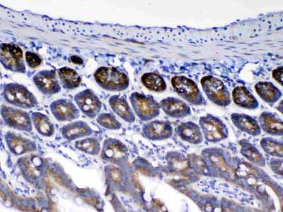 2 - Anti-HE4 Picoband Antibody ABO12992