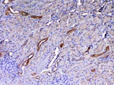 2 - Anti-HE4 Picoband Antibody ABO12992