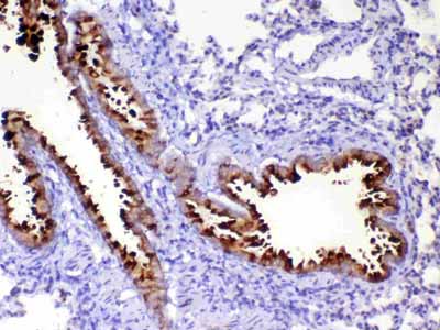 2 - Anti-HE4 Picoband Antibody ABO12992