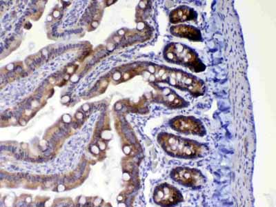 2 - Anti-HE4 Picoband Antibody ABO12992
