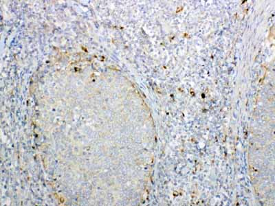 2 - Anti-GALNS Picoband Antibody ABO12999