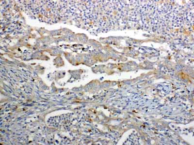 2 - Anti-GALNS Picoband Antibody ABO12999