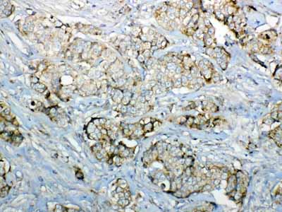 2 - Anti-GALNS Picoband Antibody ABO12999