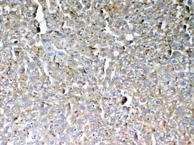 2 - Anti-GALNS Picoband Antibody ABO12999
