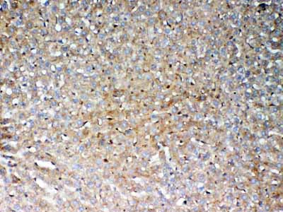 2 - Anti-GALNS Picoband Antibody ABO12999
