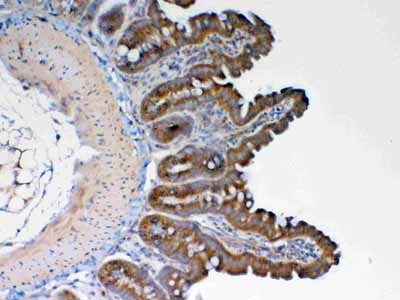 2 - Anti-GALNS Picoband Antibody ABO12999