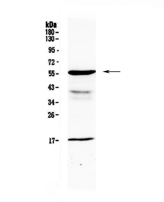 1 - Anti-GALNS Picoband Antibody ABO12999