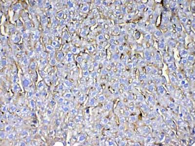 2 - Anti-CD105 Picoband Antibody ABO13000
