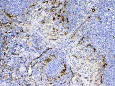 2 - Anti-CD105 Picoband Antibody ABO13000