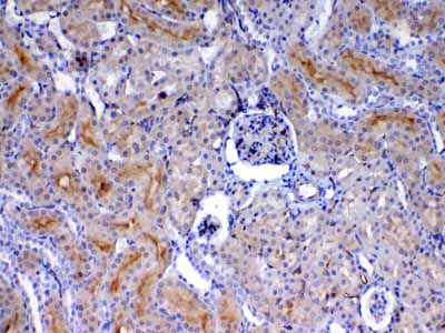 2 - Anti-CD105 Picoband Antibody ABO13000