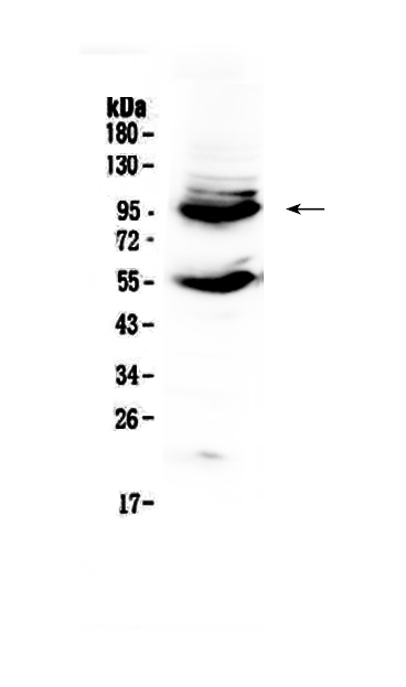 1 - Anti-CD105 Picoband Antibody ABO13000